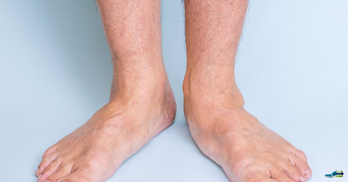 the best shoes for flat feet